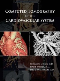 Image of Computed Tomography of the Cardiovascular System