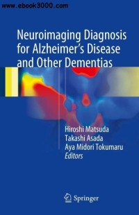 Image of Neuroimaging  Diagnosis for Alzheimers Disease and Other Dementias